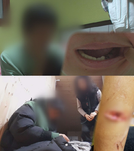 5일 SBS 궁금한 이야기 Y에서는 암투병 중인 여성이 무속인에게 3년 동안 폭행을 당했다는 사연을 집중 취재한다, <SBS 제공>